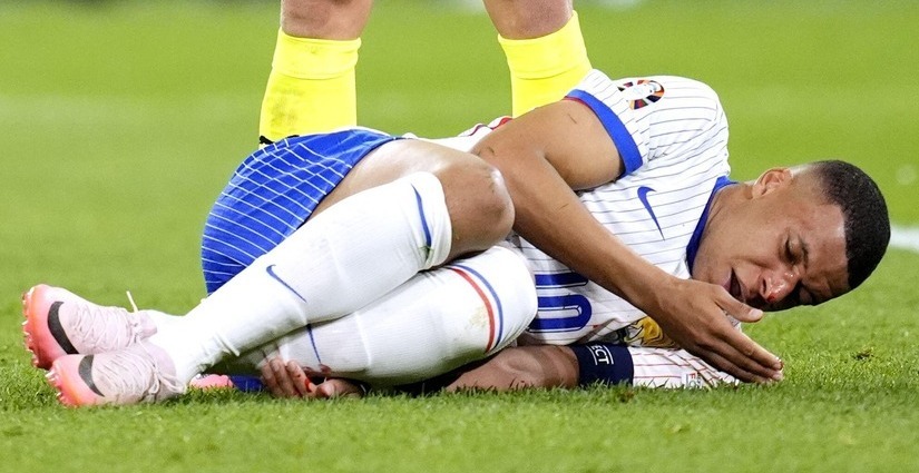 مصير نجم منتخب فرنسا مجهول بعد اصابته بكسر في أنفه